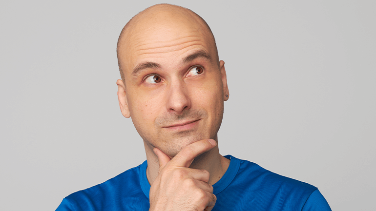Can a Completely Bald Person Have a Hair Transplant?
